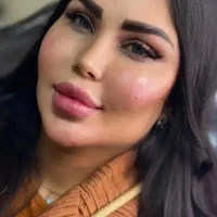 جشنواره تخفیفی ژل و بوتاکس فیلربادی prpلاغری