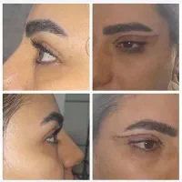 بازاریابی جذب مشتری کلینیک زیبایی