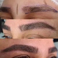 میکروبلیدینگ به روش هایپر نچرال