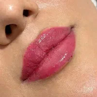 تزریق ژل و بوتاکس در شرق تهران