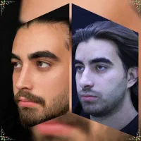 جراحی زیبایی بینی با پیزوسرجری - اقساطی