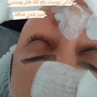 پارافین تراپی فشیال تخصصی