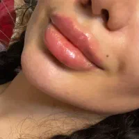 نیازمند لیزر کار و پیراپزشک برای مطب زیبایی