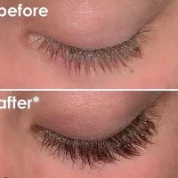 تقویت مژه  بدون ماینکسیدل