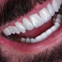 لابراتواردندان ودندانپزشکی  بااقساط