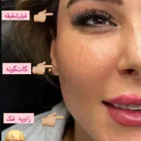 ژل بوتاکس صورت فیلر،مزوژل
