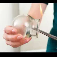 آموزش خصوصی حجامت (ویژه بانوان)