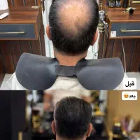 تو ۵ دقیقه کمپشتی موهات تمومه