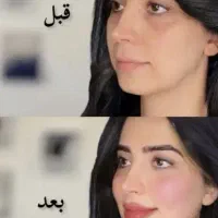 آف ژل و بوتاکس و ریموو تخصصی