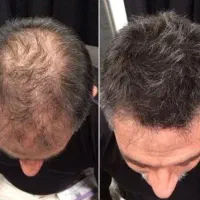 هنوز اقدام نکردی بزن رو اگهی