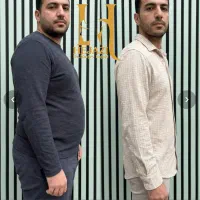 کاهش سایز و وزن با ایمپلنت لاغری