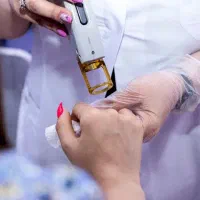 جشنواره لیزر موهای زائد شاتی کلینیک آوان