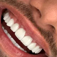 خدمات دندان پزشکی/شرایط اقساطی/کلینیک