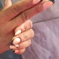 کاشت وترمیم ناخن
