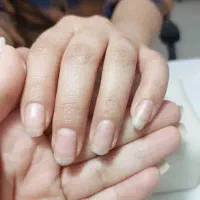 سرم دوفاز ناخن و شیرناخن ویتابلاتقویت و رشد ناخن