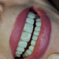 dentist endo|خدمات آرایشگری و زیبایی|کرمانشاه, |دیوار
