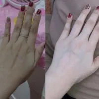 خسته نشدی از تیرگی های بدنت