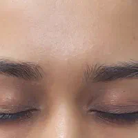 تخفیف ویژه ۵۰% کاشت ابرو جهت افتتاحیه به روش FUT