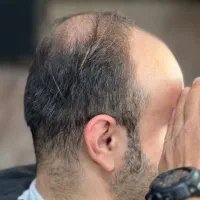 پروتزمو