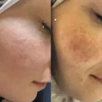 معجزه زیبایی و جوانسازی بهترین