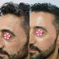 شادابی ابدی