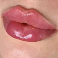 تخفیفات تزریق فیلر و بوتاکس،لیزر،هایفو،فیشیال،مزو