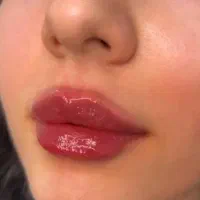 کلینیک زیبایی،جشنواره ده روزه