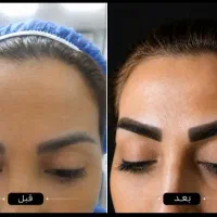 میکروهاشورو..شیدینگ لب و.. تتومینی۱۵۰۰ترمیم رایگان
