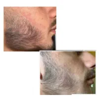بریم سراغ یه ریش کامل و یکدست