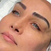 بلفارو