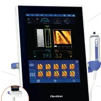 تخفیف استثنائی مرکز فیبرو اسکن امام رضا(ع)
