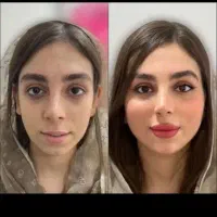 چاقی صورت پودر جوانه گندم