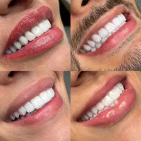 دستیار دندانپزشک