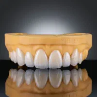 نیازمند عکاس و ادیتور برای دندانپزشکی و دندان سازی