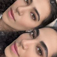 میکروبلیدینگ کرکی و مویی