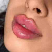 ژل و بوتاکس