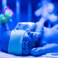 اجاره دستگاه فتوتراپی (درمان زردی نوزاد)