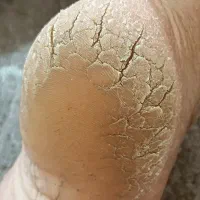 پدیکور و پدولوژی حرفه ای  لنگرود ولاهیجان