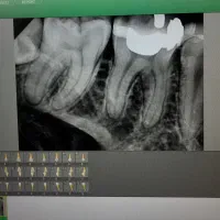 دستیار دندانپزشک