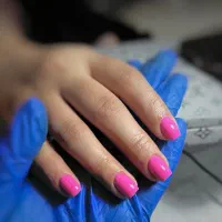 کاشت و ترمیم با قیمت استثنایی ۲۵۰