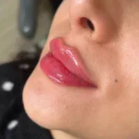 آف Fito لاغری غبغب فیلربادی بینی باسن سینه ژل ابرو
