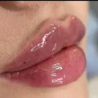 آموزش بایو فیلر بایوژل