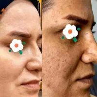 توجه تخفیف آخرماه پوست ومو و درمانی