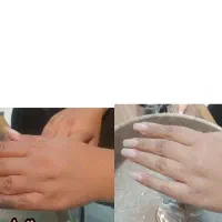 رفع تیرگی آفتاب سوختگی روشن سازی قوزک،دست ها