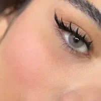 کاشت مژه هیدن تلفیقی
