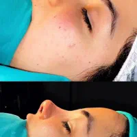جراحی زیبایی و بینی تخصصی در تهران نقد و چکی