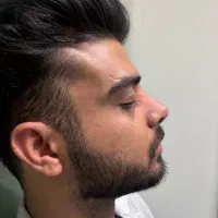 با ۳۸ تومن بینی تو عمل کن