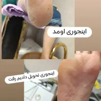 پدیکورکف پا