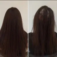 از جمع کچلا دربیا