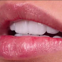 جشنواره ویژه دندانپزشکی
